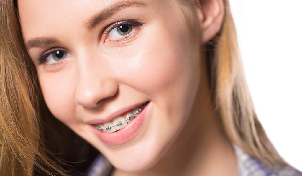 Braces & Orthodontics Braces & Orthodontics